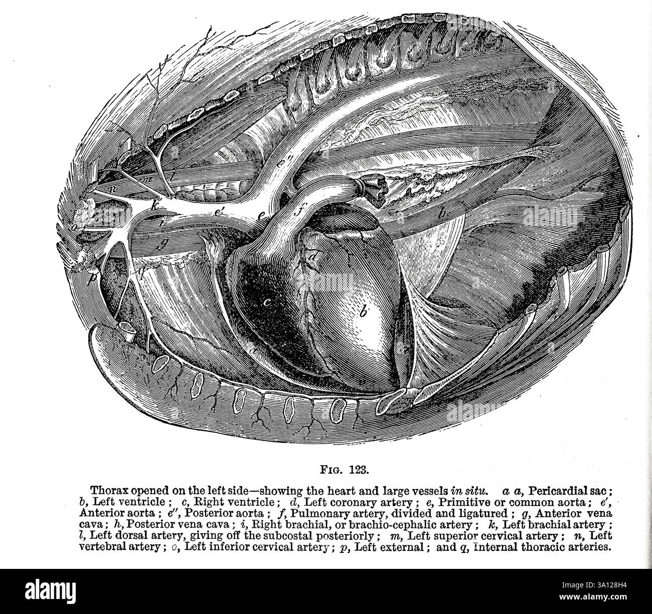 Links geöffneter Thorax — zeigt das Herz und die großen Gefäße in situ, a a, Perikardsack ; B. linker Ventrikel ; c, acht Ventrikel ; d, linke Koronararterie ; e, primitive oder gemeinsame Aorta ; e'. Aorta anterior ; c', Aorta posterior ; /, Pulmonalarterie, geteilt und ligaturiert ; g, Vena cava anterior ; h. Vena cava posterior ; i. Acht Arteria brachialis oder brachio-cephalica ; k Arteria brachialis links ; Z, Arteria dorsal links, abgeben der subkostalen posterioralen Arteria; m, Arteria cervical links Superior ; n. Arteria vertebralis links ; o Arteria cervica links inferior ; p, außen ; und q, intern Stockfoto