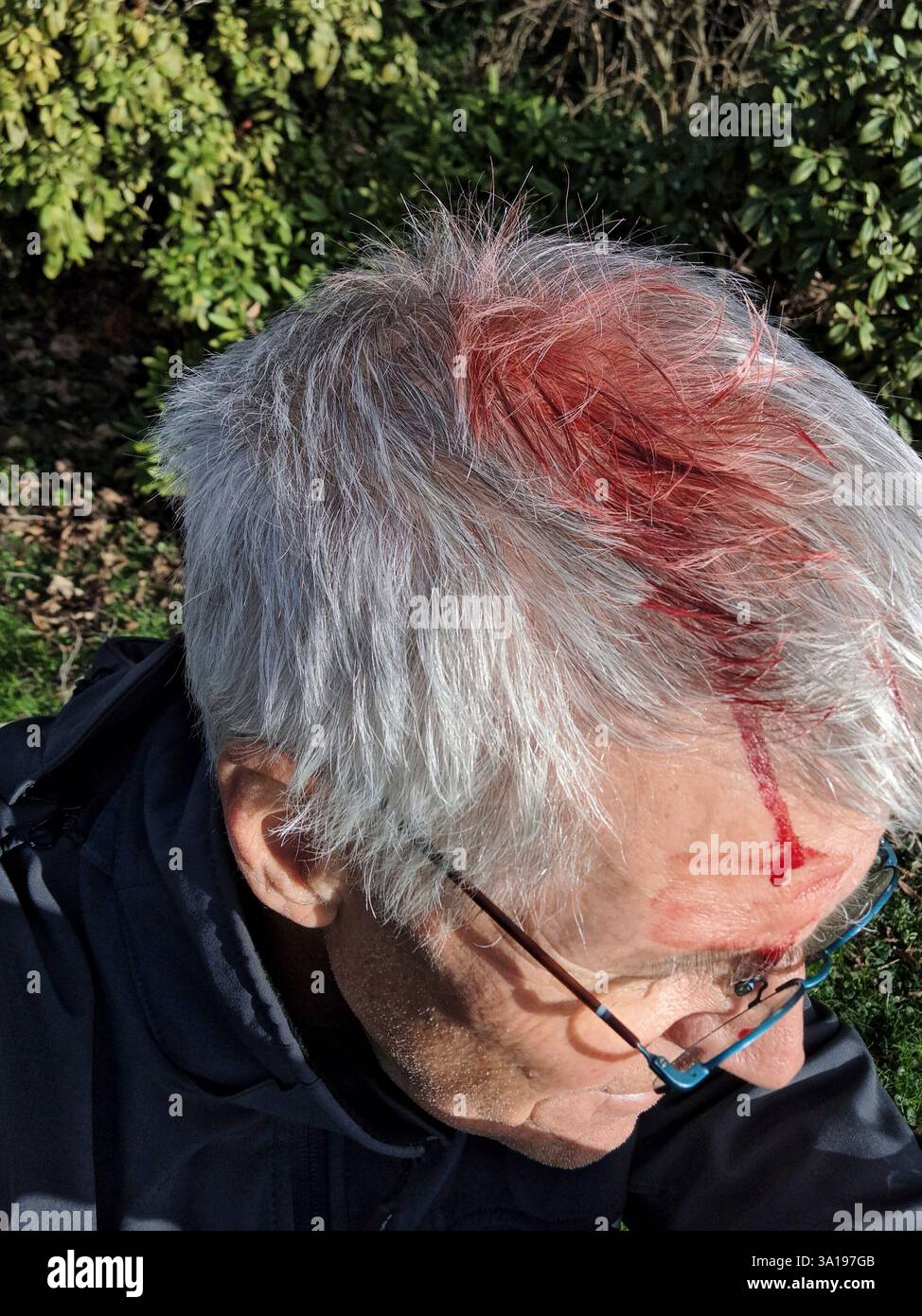 Blut am Kopf eines älteren Mannes - symbolisches Bild Stockfoto