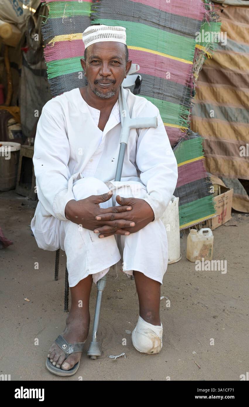 SÜDSUDAN, Oberer Nil-Staat, Stadt Renk, UNHCR-Flüchtlingscenter für Flüchtlinge und Rückkehrer aus dem Sudan-Krieg, Kriegsopfer Hamad Atiab Hamad aus Khartum verlor ein Bein bei Bombenexplosion / SÜDSUDAN, Oberer Nil-Staat, Stadt Renk, Flüchtlinge aus dem Sudan suchen Schutz vor dem Krieg, UNHCR Transit Flüchtlingslager bei Renk, Flüchtling und Kriegsopfer Hamad Atiab Hamad aus Khartum, hat seinen linken Fuß verloren Stockfoto