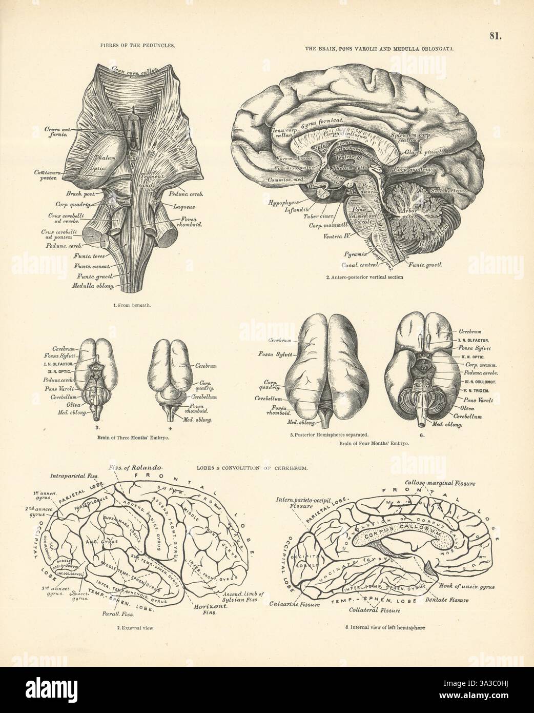 Anatomie. Stielfasern, Gehirn, Pons Varolii, Medulla, Cerebrum 1880 Stockfoto