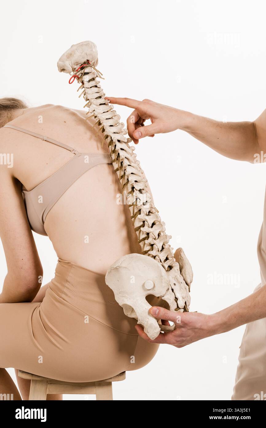 Orthopädie zeigt Wirbelsäulenmodell mit Mädchen auf weißem Hintergrund. Skoliose ist eine seitliche Krümmung der Wirbelsäule. Anatomisches Modell mit Yo Stockfoto