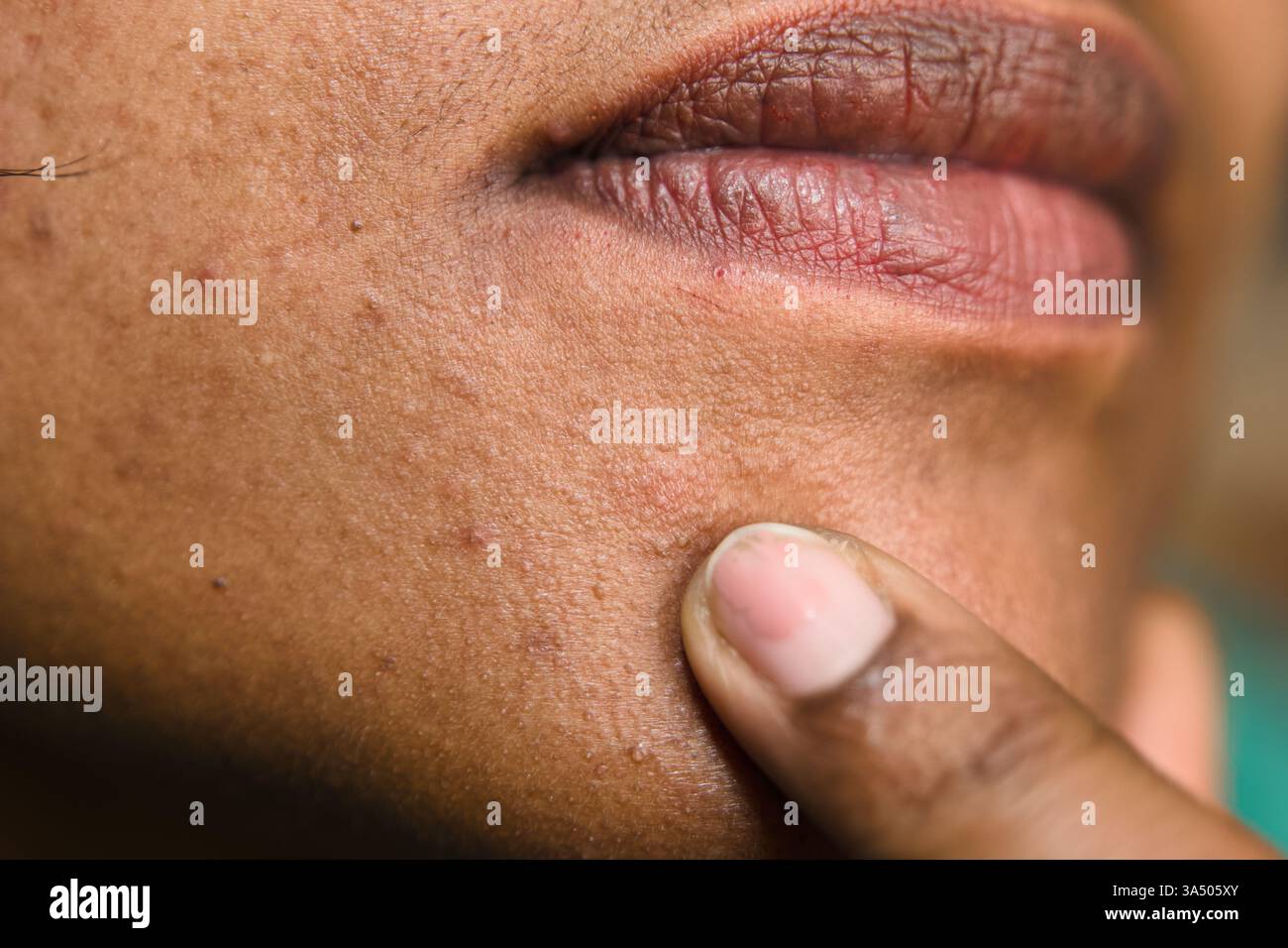 Eine Person, die sanft ihre Haut berührt und Texturen und Unregelmäßigkeiten in natürlichem Licht hervorhebt. Stockfoto