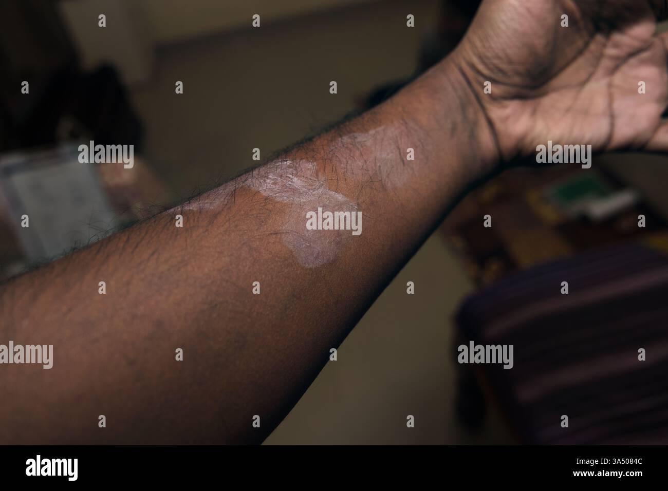 Nahaufnahme eines menschlichen Arms mit Hautstruktur und leichtem Makel auf der Oberfläche während des Innenraumes. Stockfoto