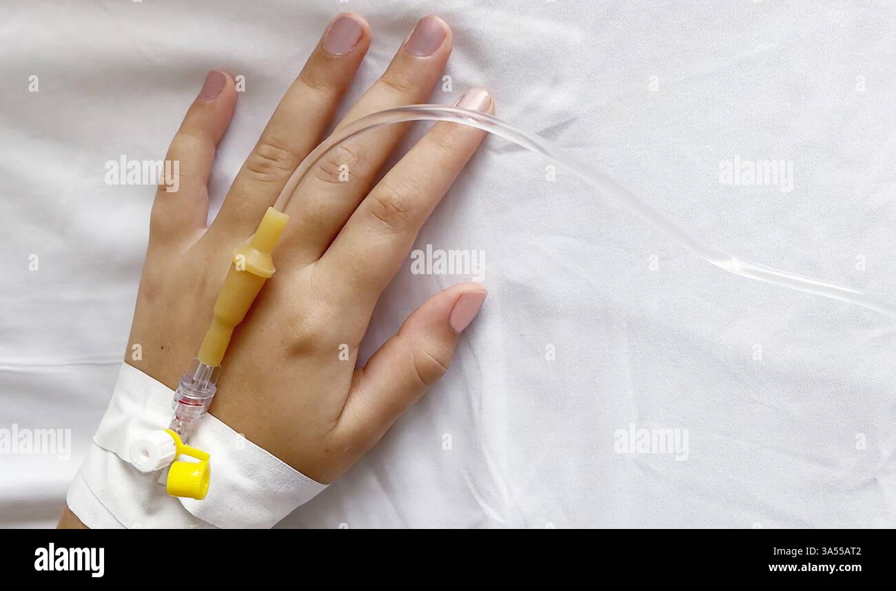 Peripherer Katheter zur Mehrtagestherapie an der weiblichen Hand im Krankenhaus, medizinischer Hintergrund Stockfoto