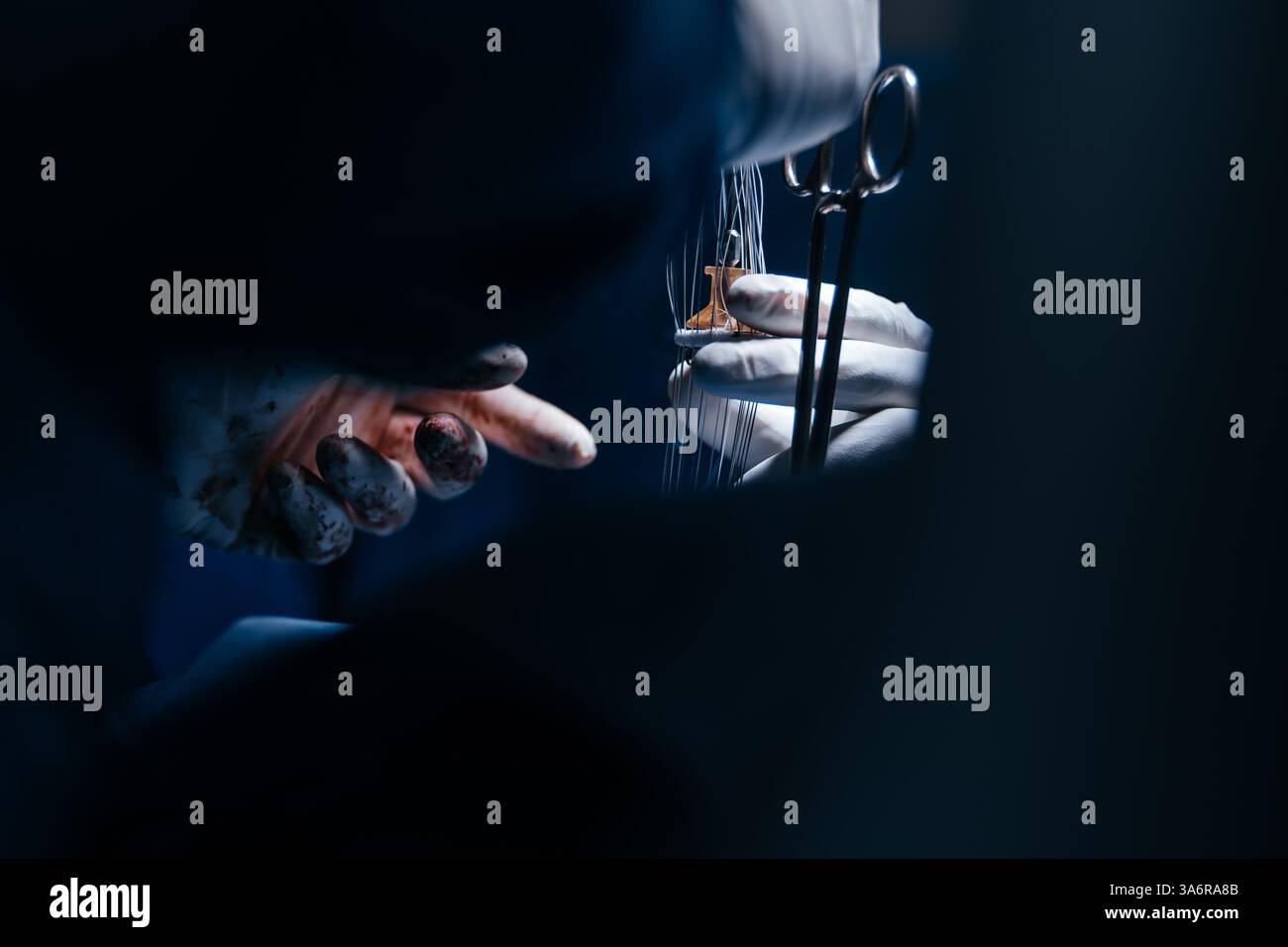 Team erfahrener Chirurgen, die eine komplexe Herzoperation mit voller Konzentration in einem gut beleuchteten Operationssaal durchführen. Technologie in der Kardiologie Stockfoto