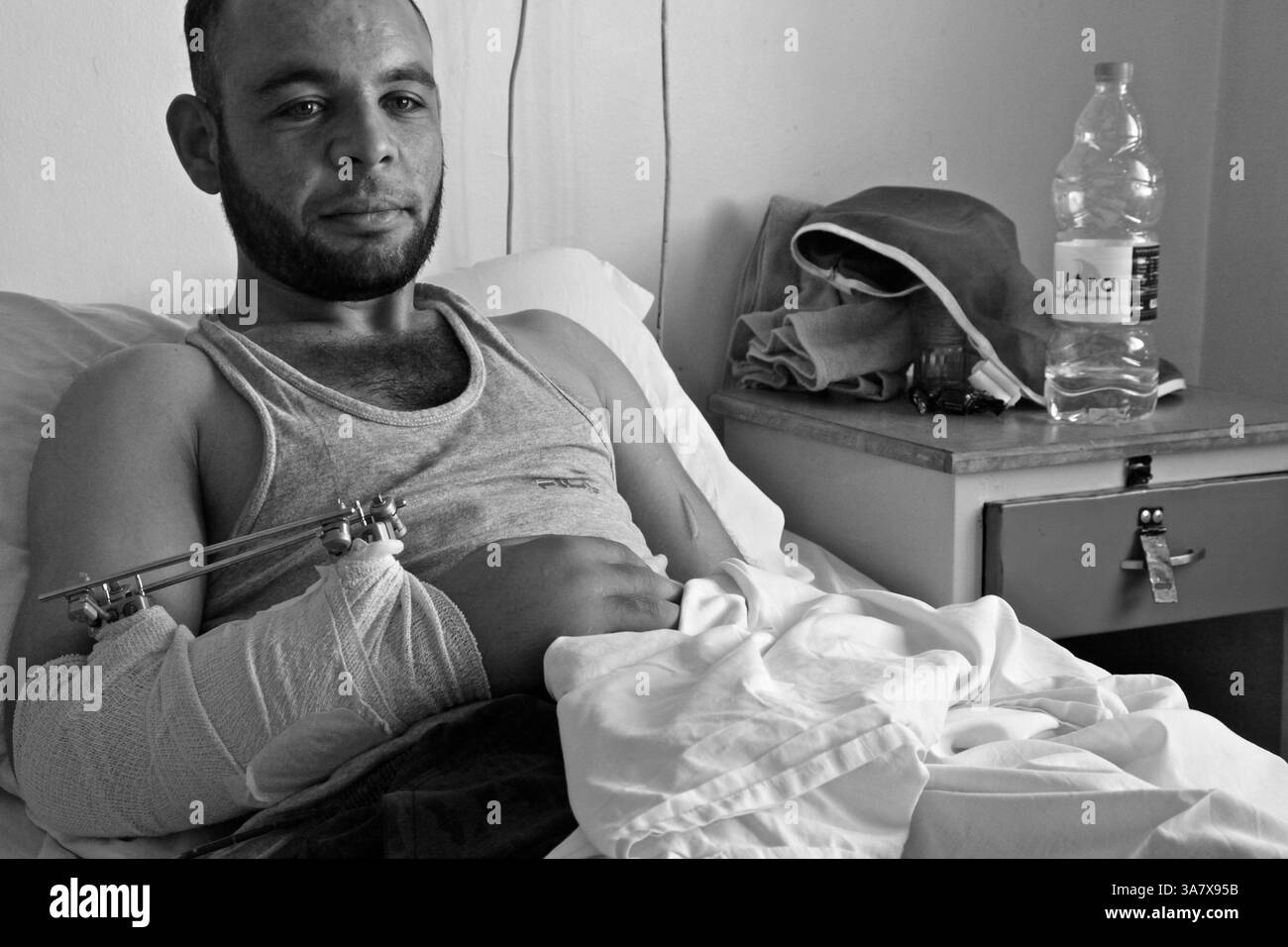 16. Juli 2012 - Amman, Jordanien - Kasim Ali, ein syrischer Demonstrant, der während einer friedlichen Demonstration in Deraa von einem Scharfschützen zweimal in den Arm geschossen wurde, wurde Ali von der Freien syrischen Armee nach Jordanien geschmuggelt, um medizinische Versorgung zu erhalten. er ist seit 4 Monaten in und aus komplizierten Operationen und plant, nach Syrien zurückzukehren, um den Kampf fortzusetzen, auch wenn er nicht vollständig erholt ist. „es gibt keinen Protest mehr in Syrien, es ist Freie Armee gegen syrische Armee“, sagte Ali. Ärzte ohne Grenzen, auch bekannt als Medecins Sans Frontieres (MSF), eröffnete 2006 in Amman, Jordanien ein chirurgisches Programm zur Behandlung von Verwundeten Stockfoto