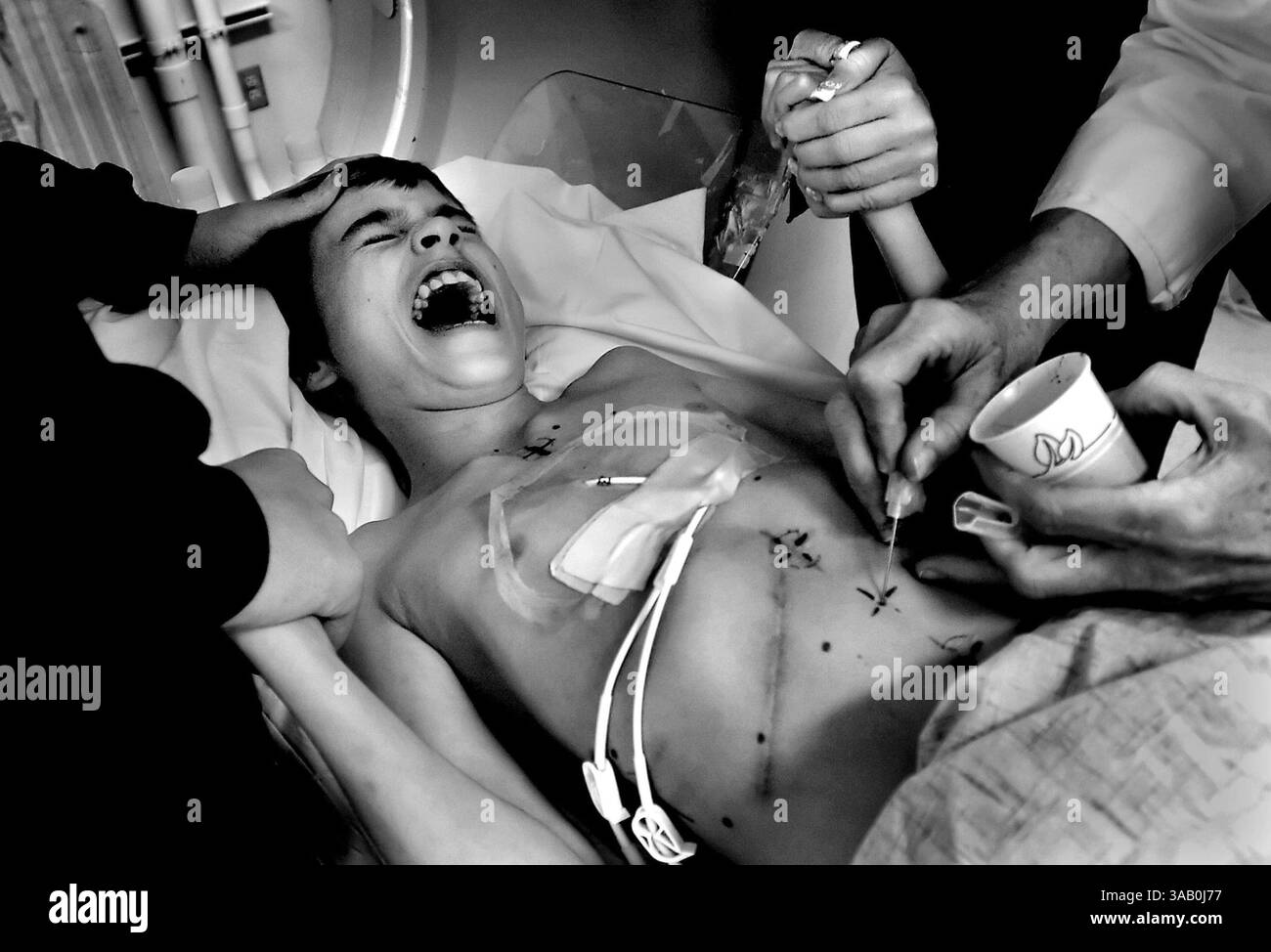 30. November 2005 - Sacramento, Kalifornien, USA - Kurzzeit nach seinem 11. Geburtstag und Cyndies 40. Geburtstag wird DEREK MADSEN, 11, von seinem Bruder MICAH MOFFE, 17, links, und seiner Mutter CYNDIE FRENCH, rechts getröstet, als er während einer Orientierung am UC Davis Medical Center ein Tattoo zur Vorbereitung der Strahlentherapie für Krebs bekommt. Micah begleitet Derek oft zu Behandlungen, obwohl seine Schularbeit leidet. (Bild: © Renée C. Byer/Sacramento Bee/zReportage.com von ZUMA Wire) Stockfoto