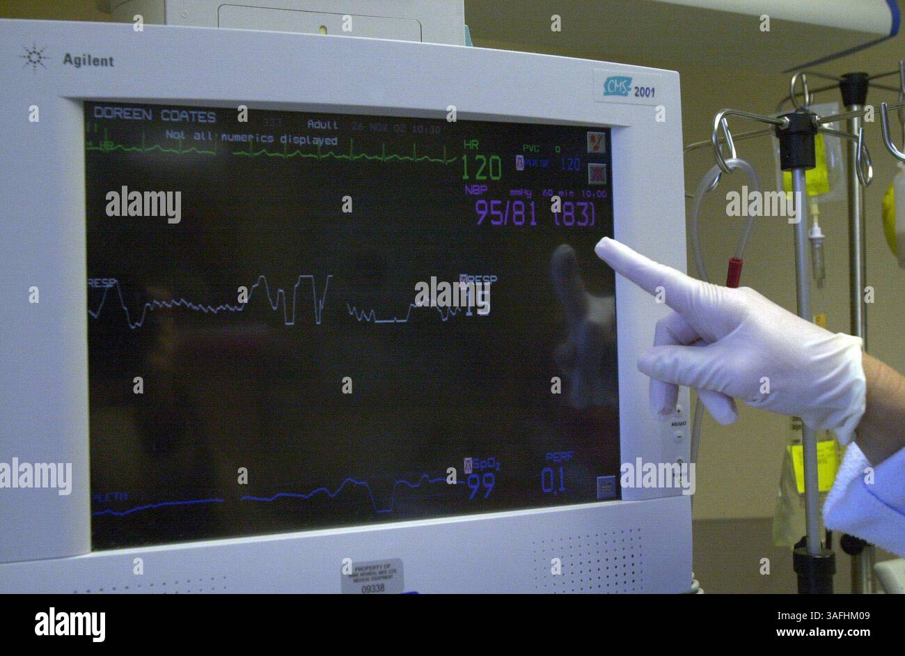 Krankenschwestern erhalten die neueste Technologie im Anne Arundel Medical Center, 26. November 2002. Auf der Intensivstation gibt es ein physiologisches Überwachungssystem mit beweglicher Leistungssäule. (Bild: Washington Times/ZUMAPRESS.com) Stockfoto