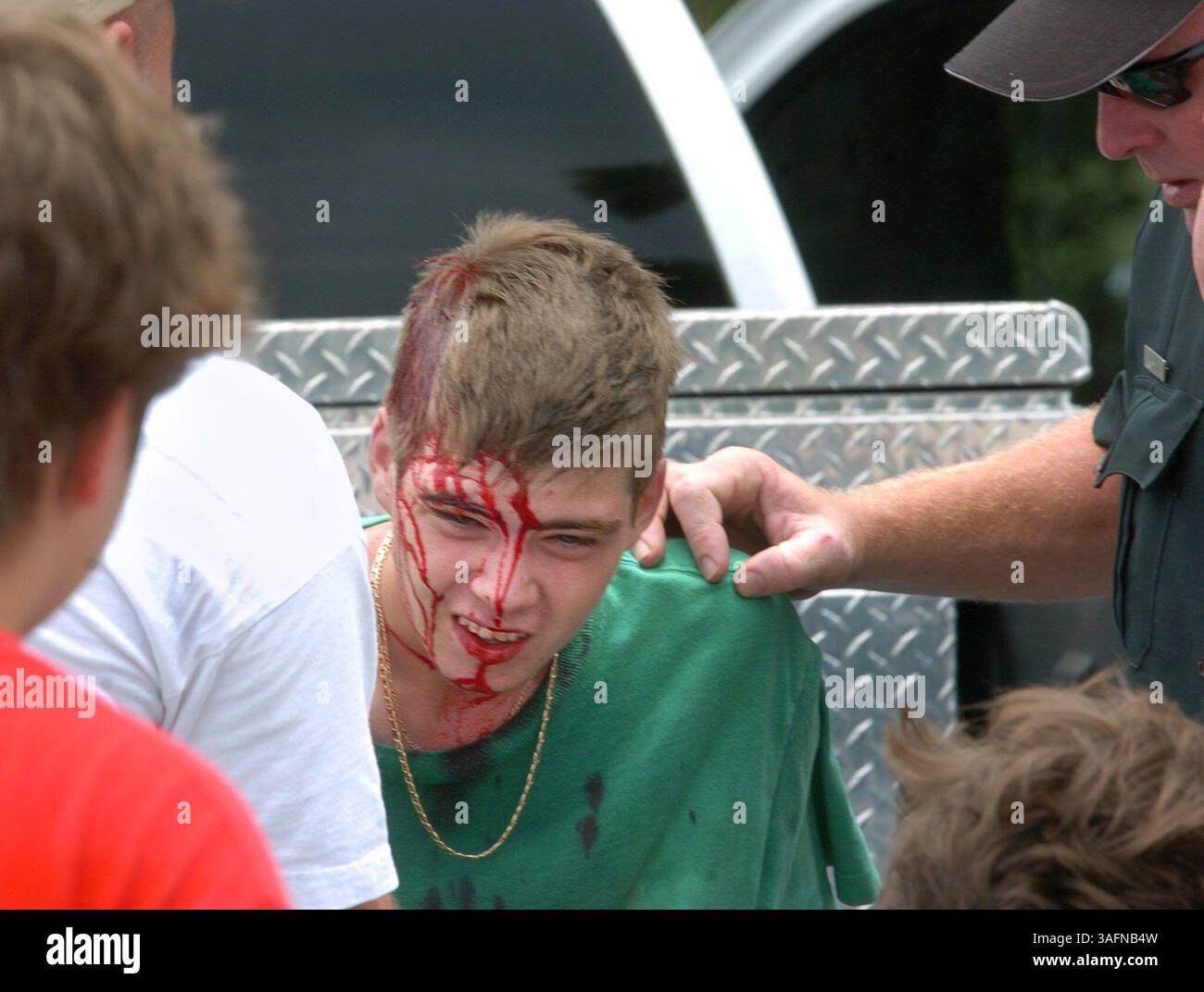 BILDUNTERSCHRIFT: (21.06.2005, CRYSTAL RIVER) Skateboarder Caleb Johnson, 18, aus Crystal River, sitzt auf der Rückseite eines Lastwagenbetts, während Deputy Kurt Lynn, rechts, nach EMS ruft, nachdem Johnson beim Skateboarding Day beim Skateboarding-Event auf dem Parkplatz der Crystal River Mall am Dienstag (21.06.2005) Nachmittag eine 6-Zoll-Wunde am Kopf erlitt. Johnson, der zum Zeitpunkt seiner Verletzung keinen Helm trug, sagte, dass er versucht habe, einen Trick auszuführen, aber dass die Räder seines Skateboards verfangen wurden, während er weiterfuhr. "Ich flog direkt rüber und aß am Ende die andere Rampe," Joh Stockfoto