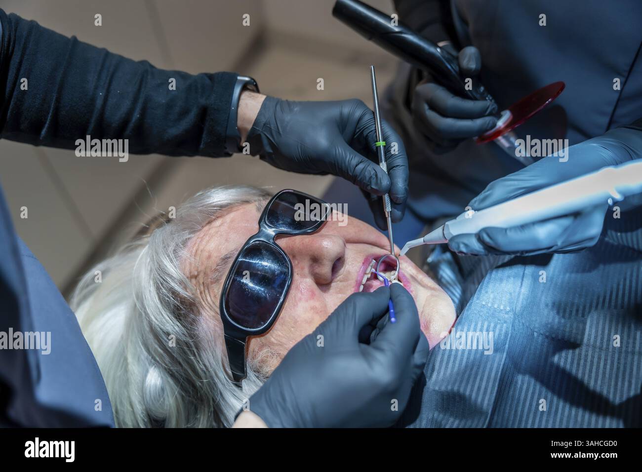 Zahnärzte, die spezielle Werkzeuge verwenden, führen eine Zahnaufhellung bei einer älteren Patientin durch, die eine Schutzbrille trägt Stockfoto