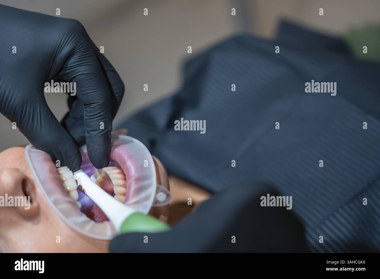 Zahnarzt, der schwarze Handschuhe trägt, verwendet einen Retraktor und eine spezielle elektrische Bürste, um die Zähne des Patienten aufzuhellen Stockfoto