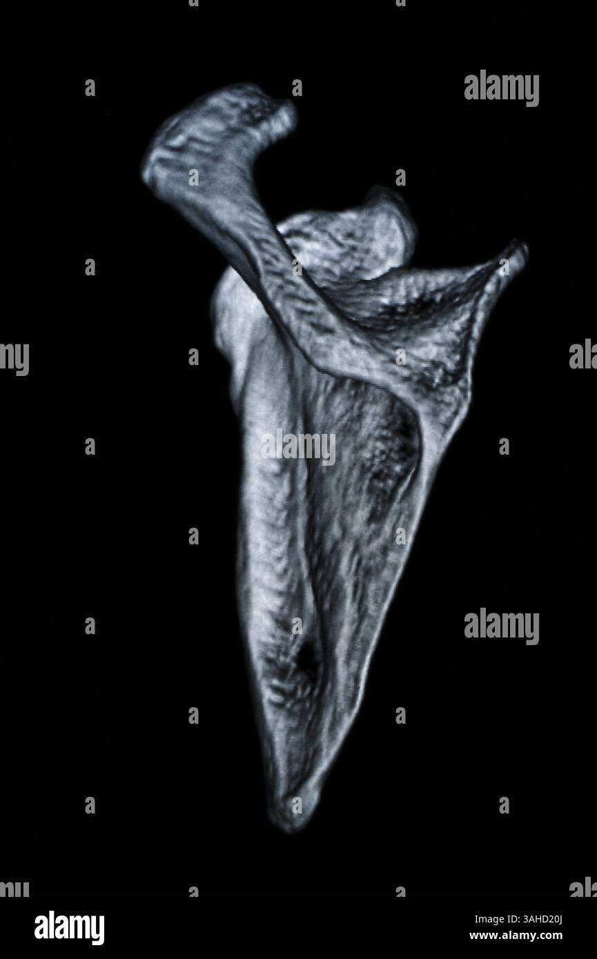 Human Bone CT-Bilder Stockfoto