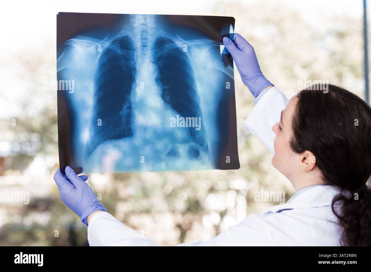 Junge Ärztin, die eine Thoraxröntgenaufnahme eines Patienten mit langer covid im Krankenhaus analysiert. Stockfoto