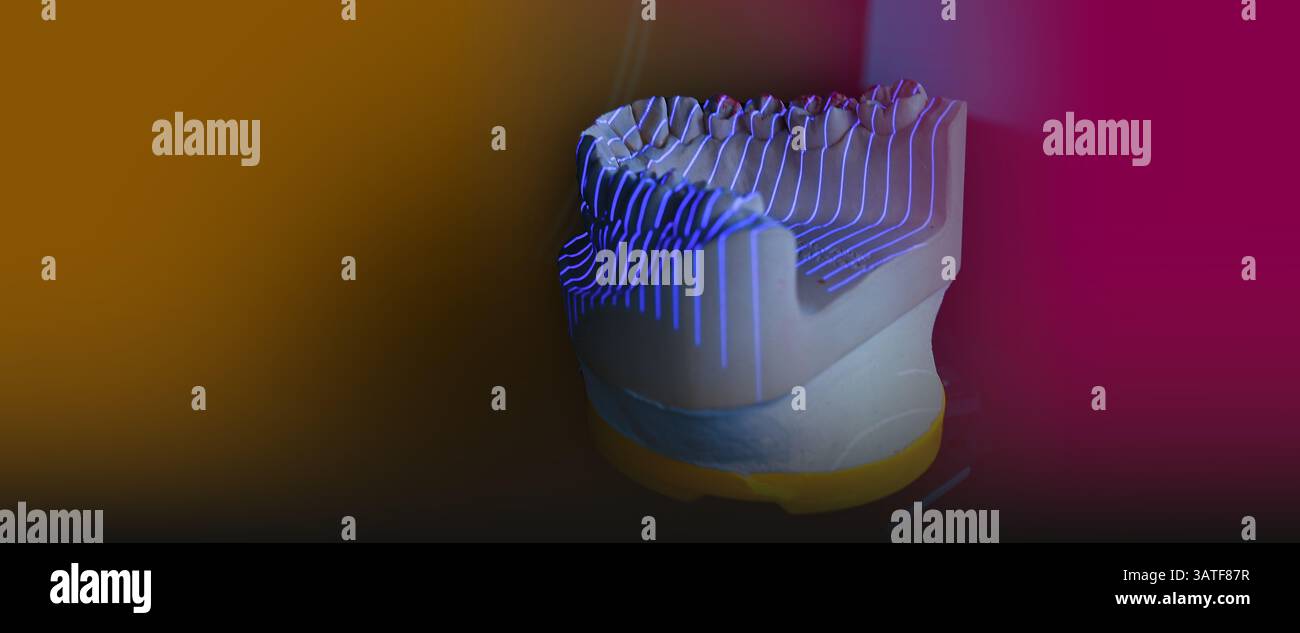 Zahntechnische 3D-Scan-Scans aus einem Zahnmodell für Zahnersatz Stockfoto