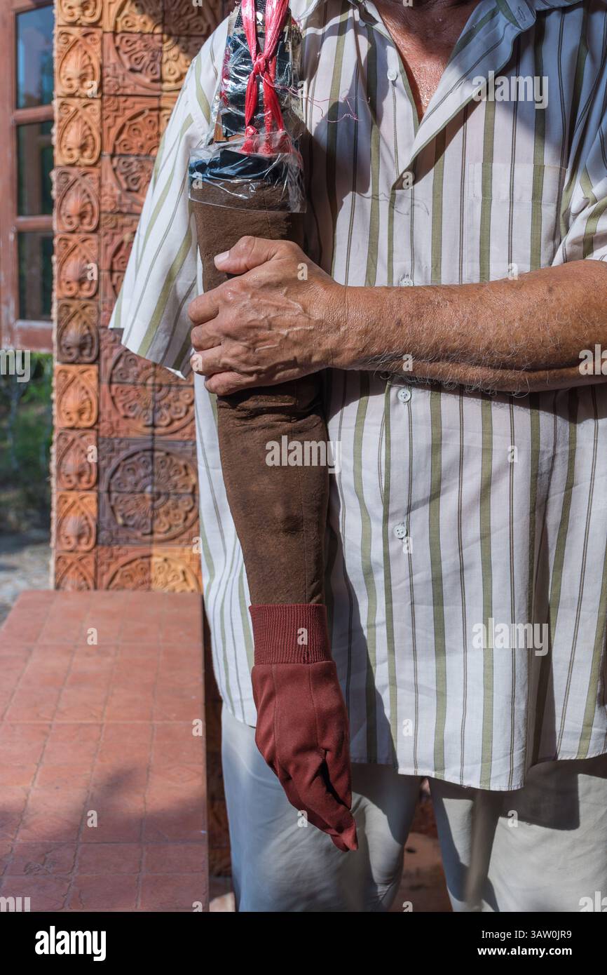 Asien ältere Männer haben gebräunte Haut, die durch einen Unfall mit einem Arm und einer Armprothese behindert wurde Stockfoto