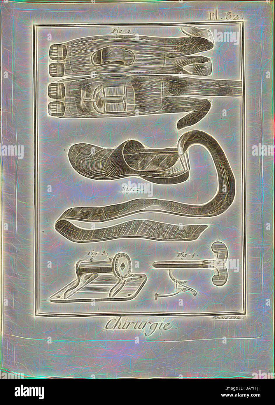 Eine Sammlung von chirurgischen Instrumenten und Werkzeugen mit detaillierten Abbildungen und Messungen, die ihr Design und ihre Funktionalität im Zusammenhang mit chirurgischen Eingriffen hervorheben., Chirurgie 28, Medizinprodukt für Achillessehne, unterzeichnet: Benard direx, PL. 32, nach S. 48, Benard (Richtung), 1778, Denis Diderot; M. d'Alembert: Encyclopédie, ou dictionnaire raisonné des Sciences, des Arts et des métierss, des Arts et des métiers. Genève: chez Pellet, MDCCLXXVIII [1778], Klassische Kunst mit modernem Touch, neu interpretiert von Artotop Stockfoto