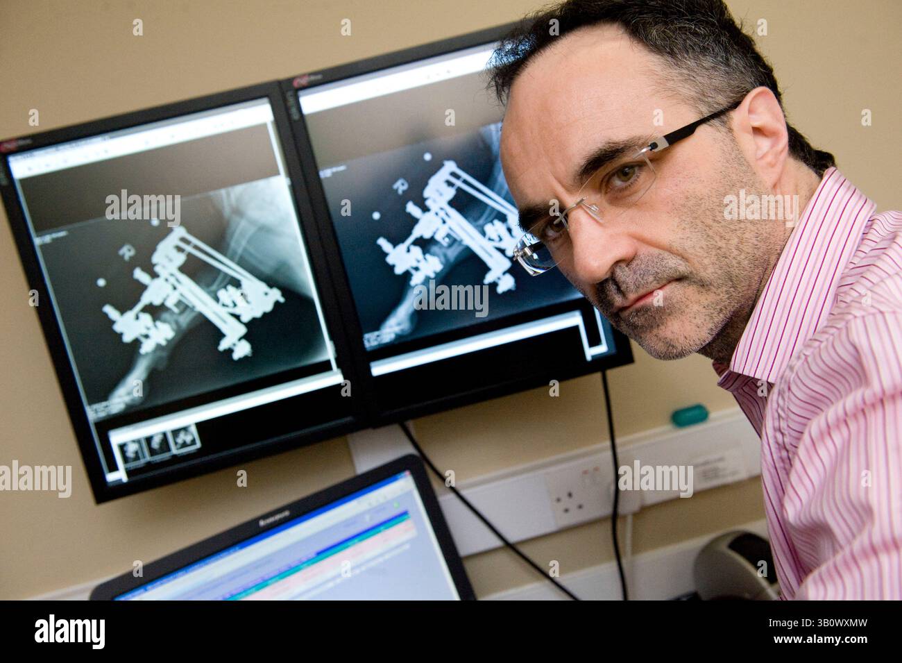 14. Dezember 2010 - Eashing, Surrey, Vereinigtes Königreich - Noel mit Röntgenaufnahme von Peggys Unterarm mit Fixateur und Korrektur. Fast alle anderen Tierärzte würden nicht versuchen, eine solche Spesenkorrektur nicht zu erwähnen, sondern stattdessen ihr Bein amputieren. In einem solchen Fall sind die Kosten hoch, bis zu mehreren Tausend Pfund. Noel schwingt seine eigenen Kosten und zahlt teilweise für die Teile. Die Eigentümer zahlen einen Beitrag zu den Artikeln. Noel Fitzpatrick ist ein Pionier-Tierarzt, ein sogenannter bionischer Tierarzt und seine millionenschwere Tierarztpraxis befindet sich in Eashing, Surrey, England. (Kreditbild: © Ni Stockfoto