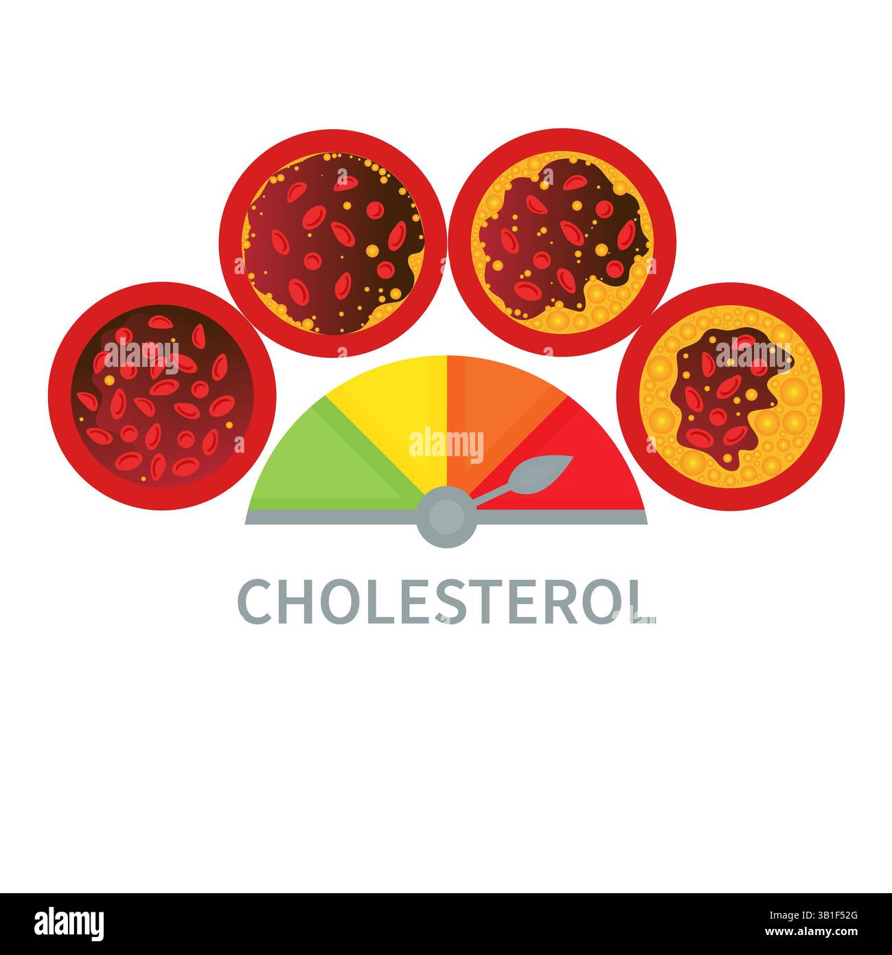 Cholesterinspiegelskala, Abbildung. Messgerät für LDL- und HPL-Lipoprotein. Testanzeige für hohen und niedrigen Fettgehalt. Atherosklerose-Risikoindikator. Stockfoto