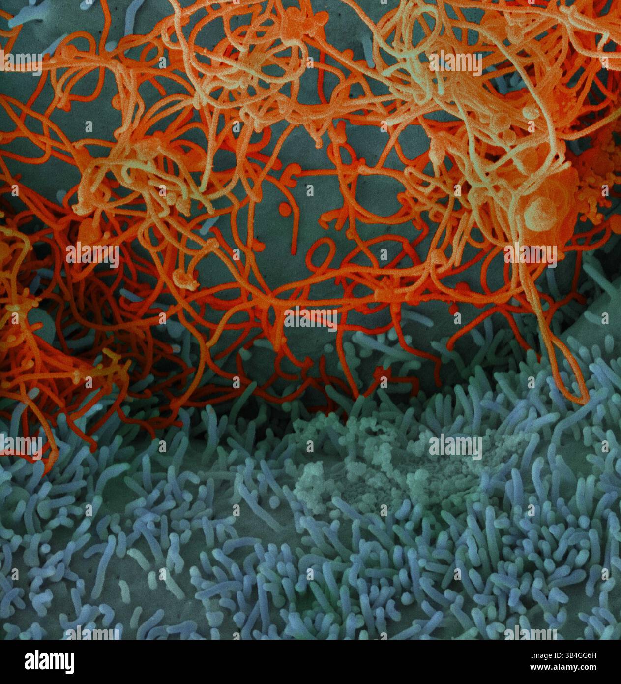 11. Dezember 2014 - Atlanta, Vereinigte Staaten von Amerika - mikroskopische Ansicht des Ebola-Virus aus einer Blutprobe des Mali-Opfers. Farbiges Rasterelektronenmikrogramm filamentöser Ebola-Viruspartikel, die an einer chronisch infizierten VERO-E6-Zelle gebunden sind und aus ihr heraus wachsen. (Kreditbild: © NIAID via ZUMA Wire) Stockfoto
