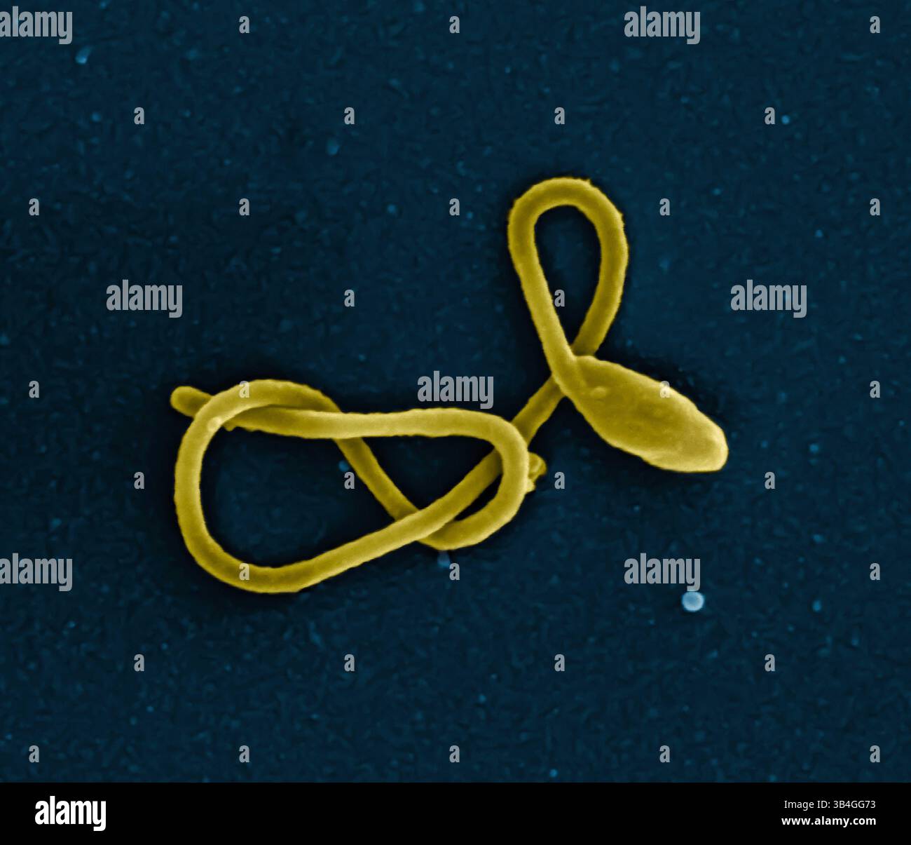 24. November 2014 - Atlanta, Vereinigte Staaten von Amerika - mikroskopische Ansicht des Ebola-Virus-Partikels. Farbige Rasterelektronenmikrographie filamentöser Ebola-Viruspartikel. (Kreditbild: © NIAID via ZUMA Wire) Stockfoto