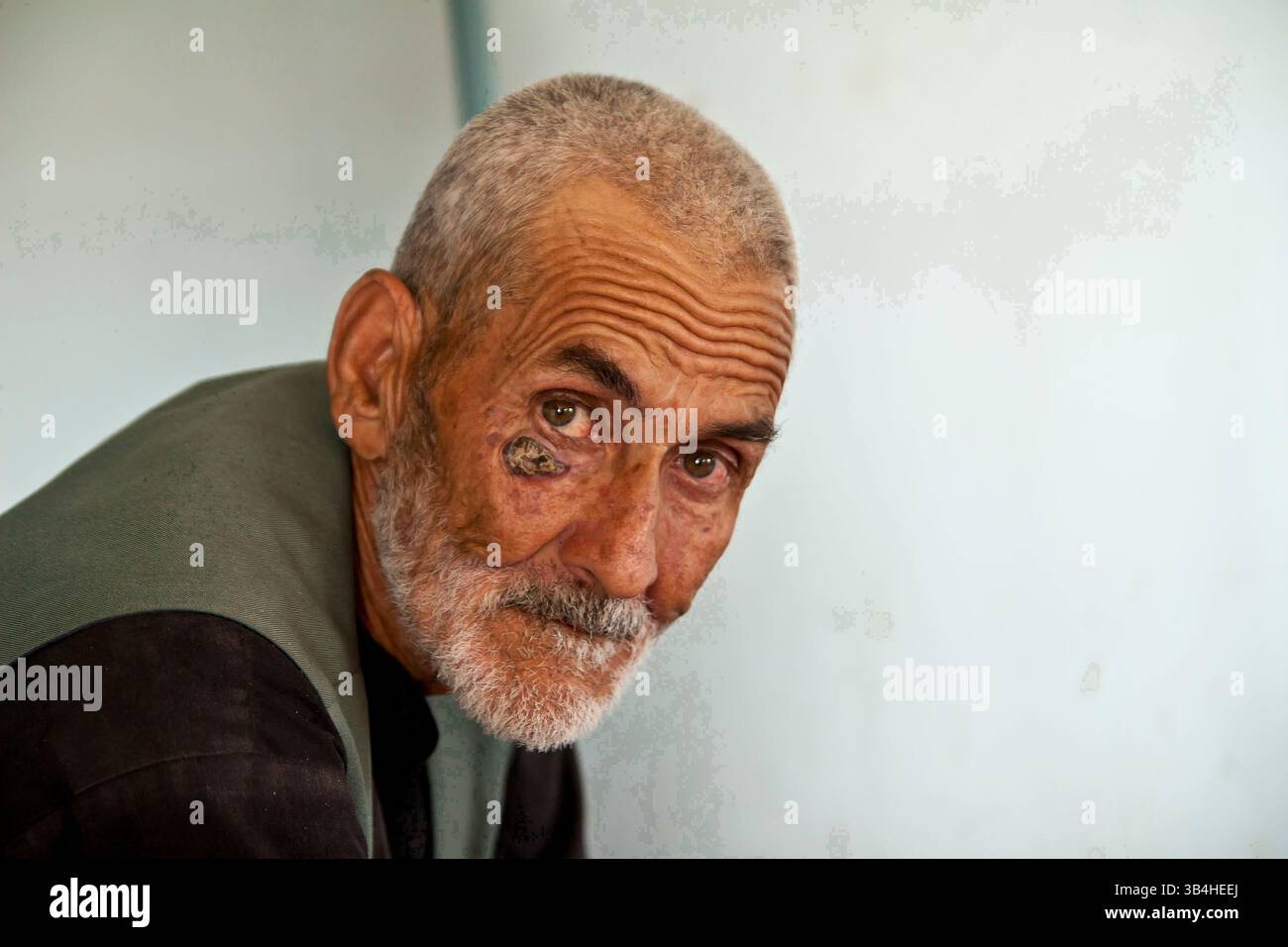 29. August 2009 - Kabul, Afghanistan - Ein psychisch kranker Mann im Marastoon. Marastoons, was in Paschto "Orte der Hilfe" bedeutet, sind in Afghanistan eine lange Tradition. Sie wurden 1930 von der Regierung als öffentliche Einrichtungen eingerichtet und bieten den Ärmsten der Armen vorübergehend Unterkunft und Bildung an. (Kreditbild: © Theodore Liasi/ZUMApress.com) Stockfoto
