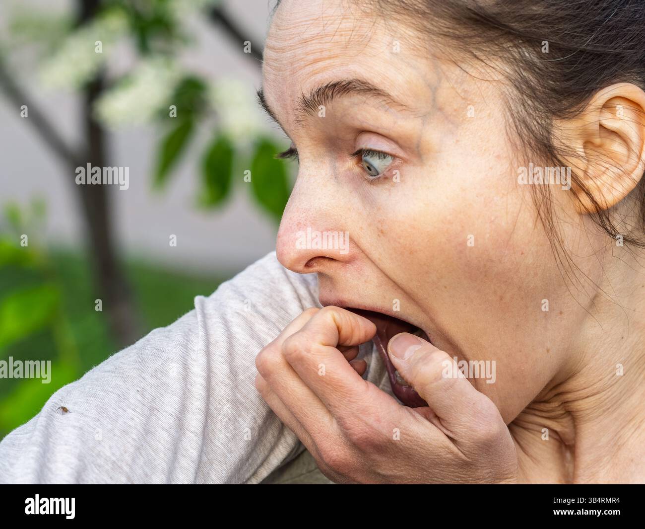 Eine Nahaufnahme einer Hirschzecke, die am Arm einer Person herumkriecht. Die Arachnide ist rötlich gefärbt und hat ihre Beine als Kriechen ausgestreckt Stockfoto