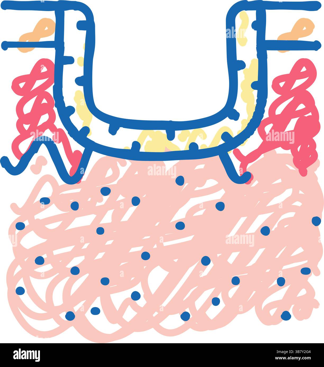 Hypertrophe Aknennarbe Icon Kritzelillustration Stock Vektor