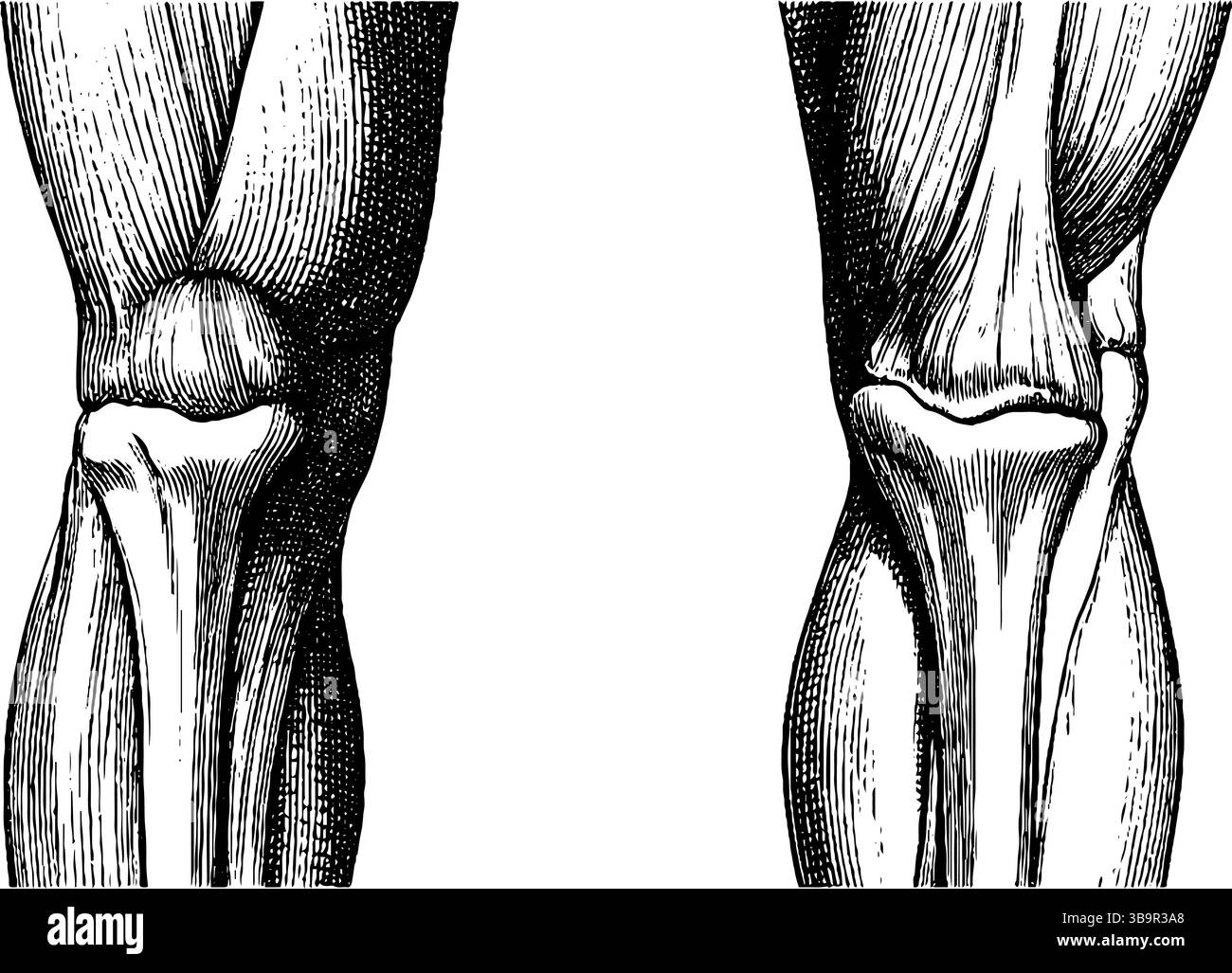 Gravierte anatomische Darstellung der menschlichen Bein- und Kniestruktur für die medizinische Anwendung. Stock Vektor