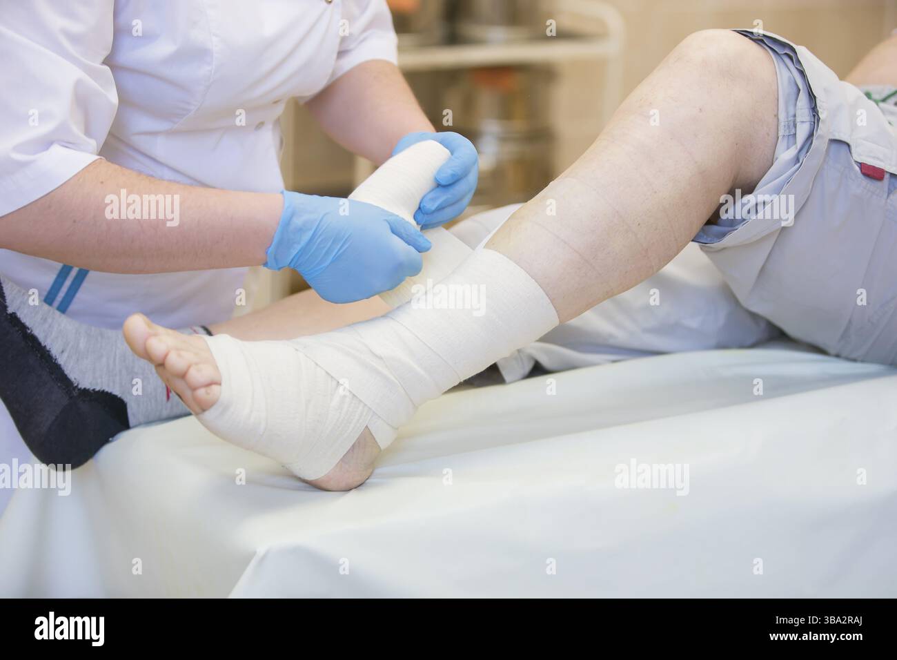 Krankenschwester Bandagen das Bein. Bruch der unteren Gliedmaßen. Behandlung von gebrochenen Knochen. Ein Gips verhängen. Patienten der chirurgischen Abteilung. Die Hände des Arztes tig Stockfoto