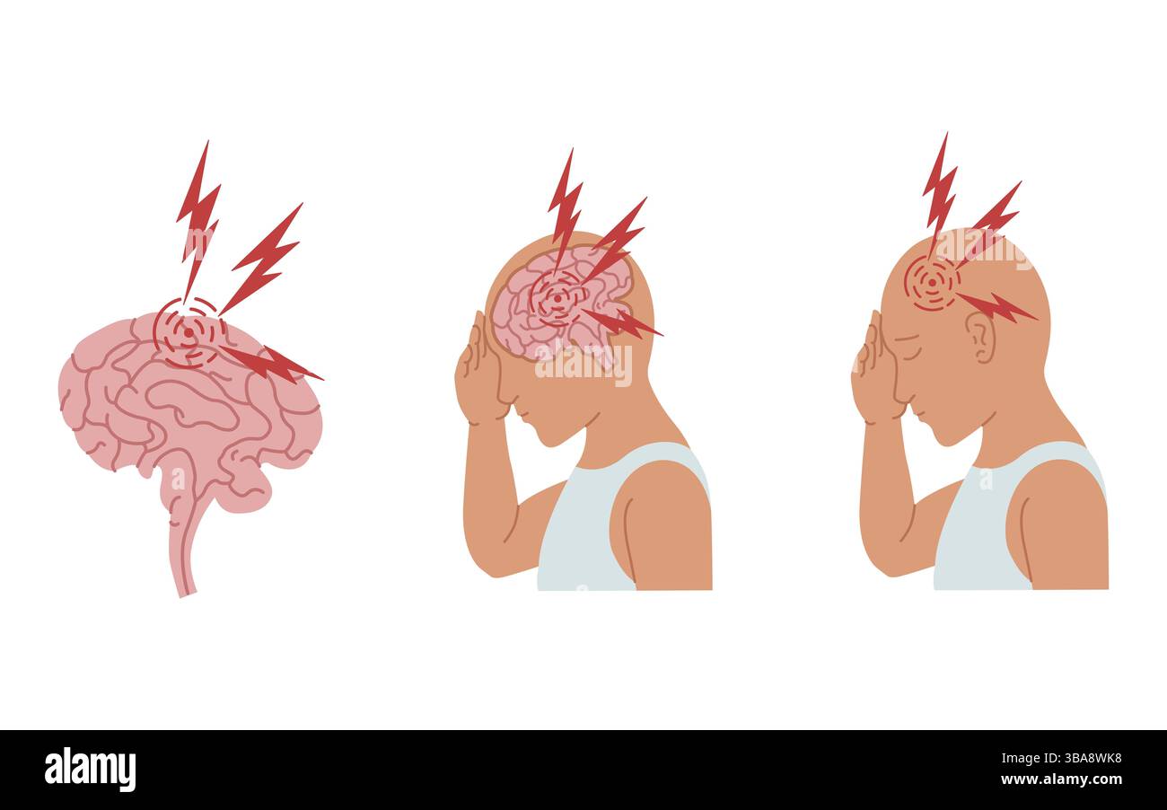 Vektorillustration einer Person, die Kopfschmerzen und Entzündungen des menschlichen Gehirns erlebt Stockfoto