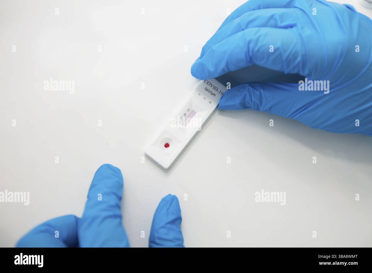 Die Hände des Arztes halten einen Expresstest auf Coronavirus Stockfoto