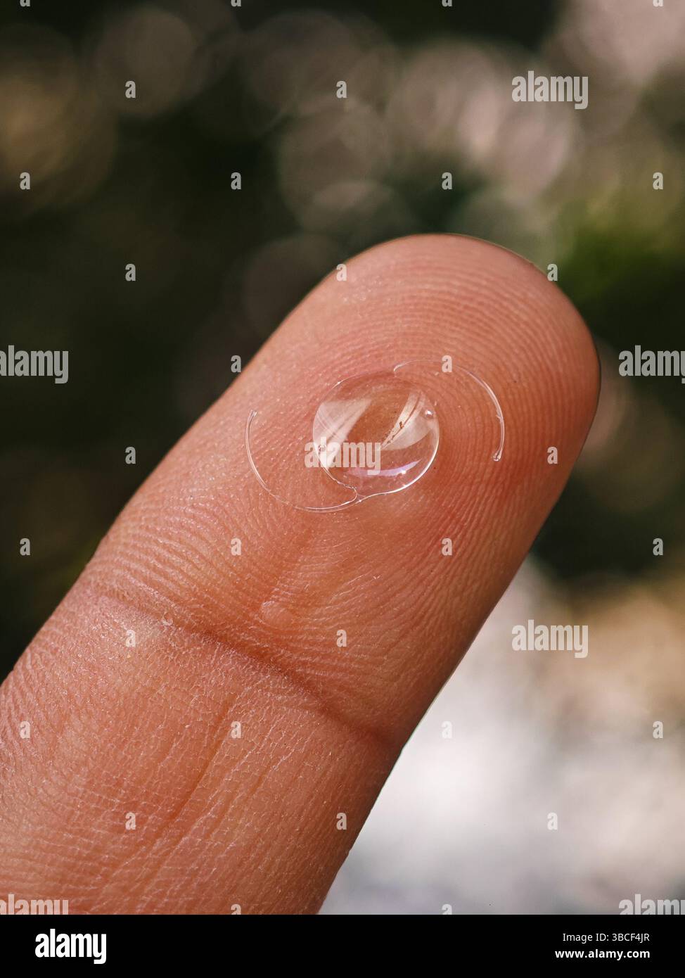 Eine Phaco-Linse liegt auf einer Fingerspitze auf Stockfoto