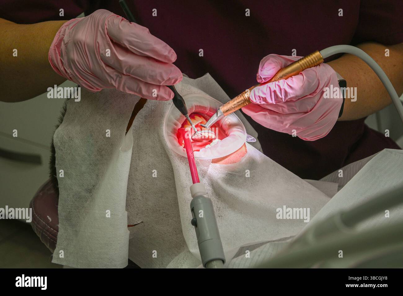 Zahnarzt arbeitet an den Zähnen des Patienten mit speziellen Werkzeugen und Geräten, um die Mundgesundheit sicherzustellen. Stockfoto