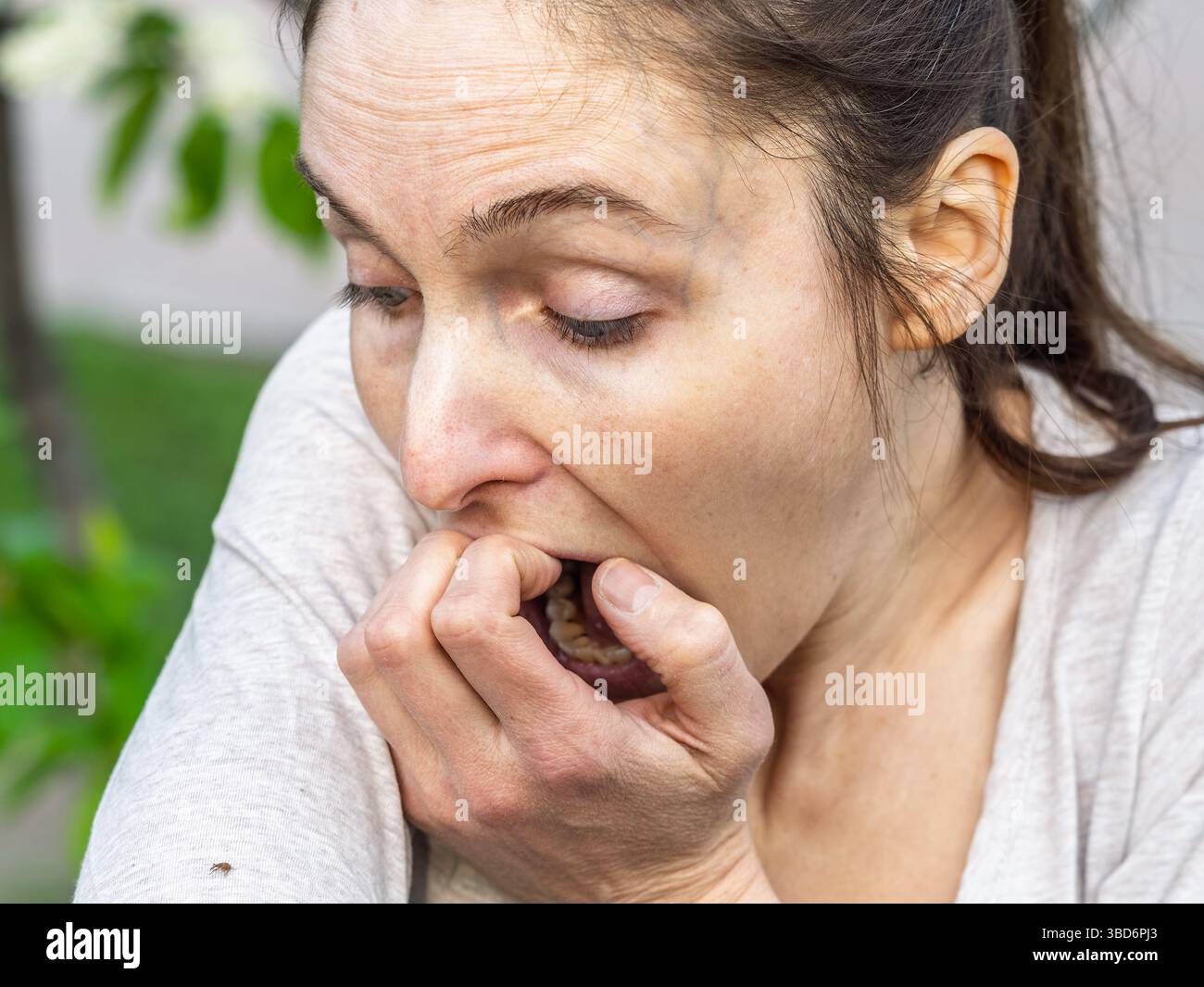 Eine Nahaufnahme einer Hirschzecke, die am Arm einer Person herumkriecht. Die Arachnide ist rötlich gefärbt und hat ihre Beine als Kriechen ausgestreckt Stockfoto