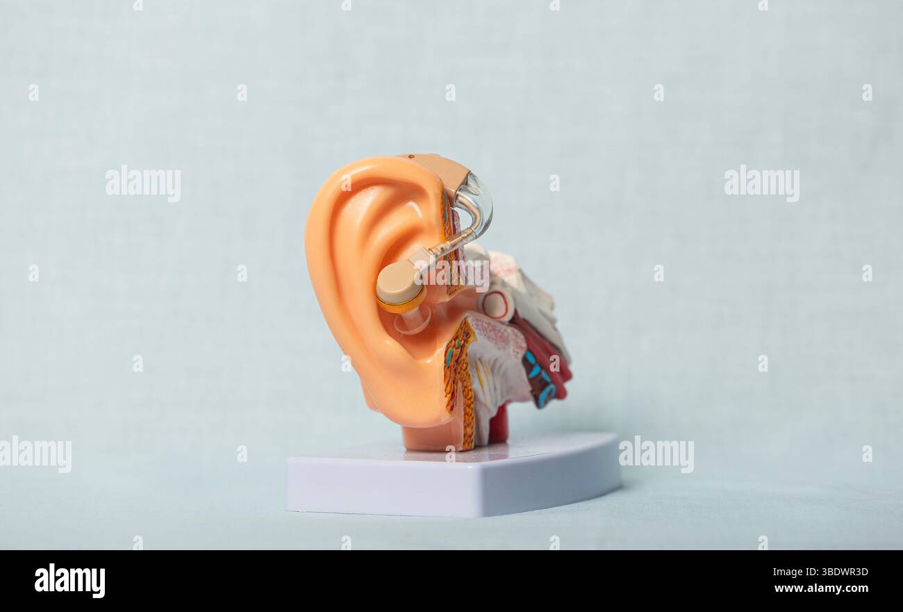 Nahaufnahme eines anatomischen Modells mit moderner Hörhilfe im Ohr, die Struktur des Innenohrs und Technologie zur Unterstützung von Hörverlust hervorhebt Stockfoto