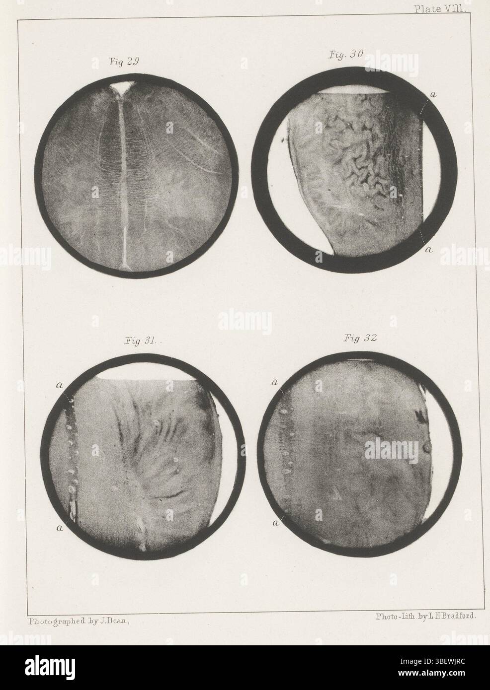 Bradford & Co, L.H., Dean, John, vier Querschnitte einer Medulla oblongata, Recto, fotomechanischer Druck, Seite, Fotos, fotografische illustrierte Bücher, Platte VIII. Abb. 29. Abb. 31. Abb. 32., Höhe 301 mm, Breite 230 mm, 1831 - 1888, Fotograf, 1854 - 1864, Papier, Fotolithographie, Druckmaschine, Druckmaschine Stockfoto
