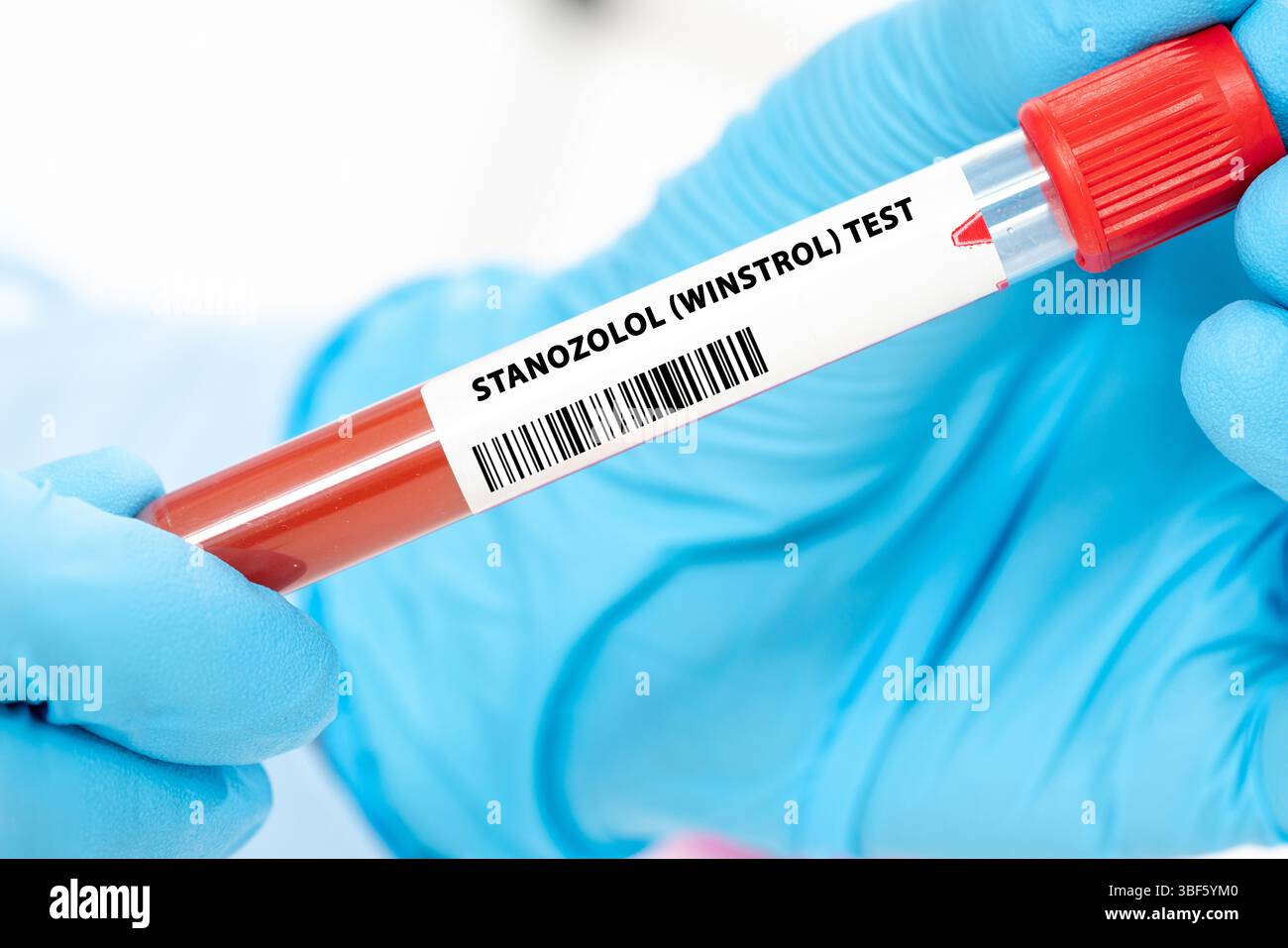 Stanozolol (winstrol)-Test. Erkennt Stanozolol, ein anaboles Steroid, das in den meisten Sportorganisationen verboten ist. Stockfoto