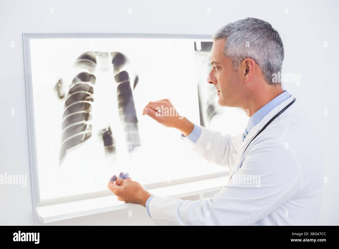 Thoraxröntgenfilm glüht auf Lichttafel im klinischen Übersichtsbereich mit Stethoskop-Hängung Stockfoto