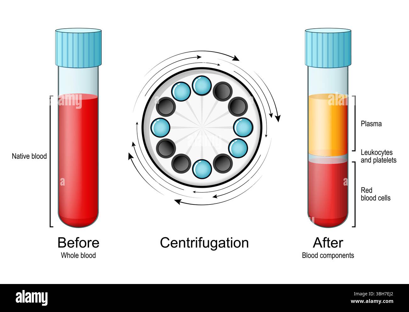 Vollblut im Reagenzglas vor und nach dem Zentrifugieren. Blutbestandteile, Plasma, Erythrozyten und der Buffy-Mantel wie Leukozyten und Blutplättchen Stock Vektor
