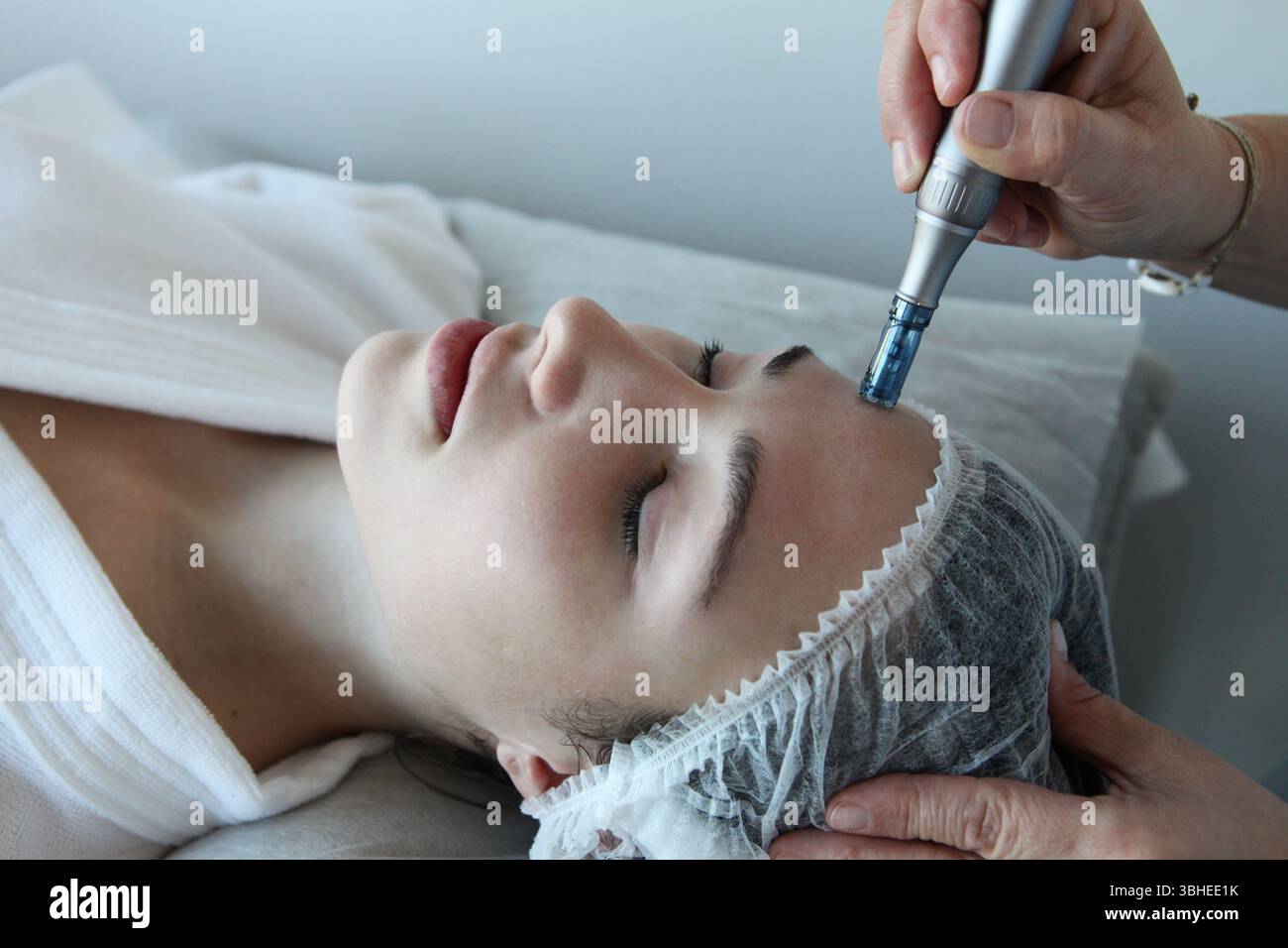 Nahaufnahme einer Frau, die mit Derma Pen durch professionelle Kosmetikerin in der Schönheitsklinik oder im Spa-Salon behandelt wird Stockfoto