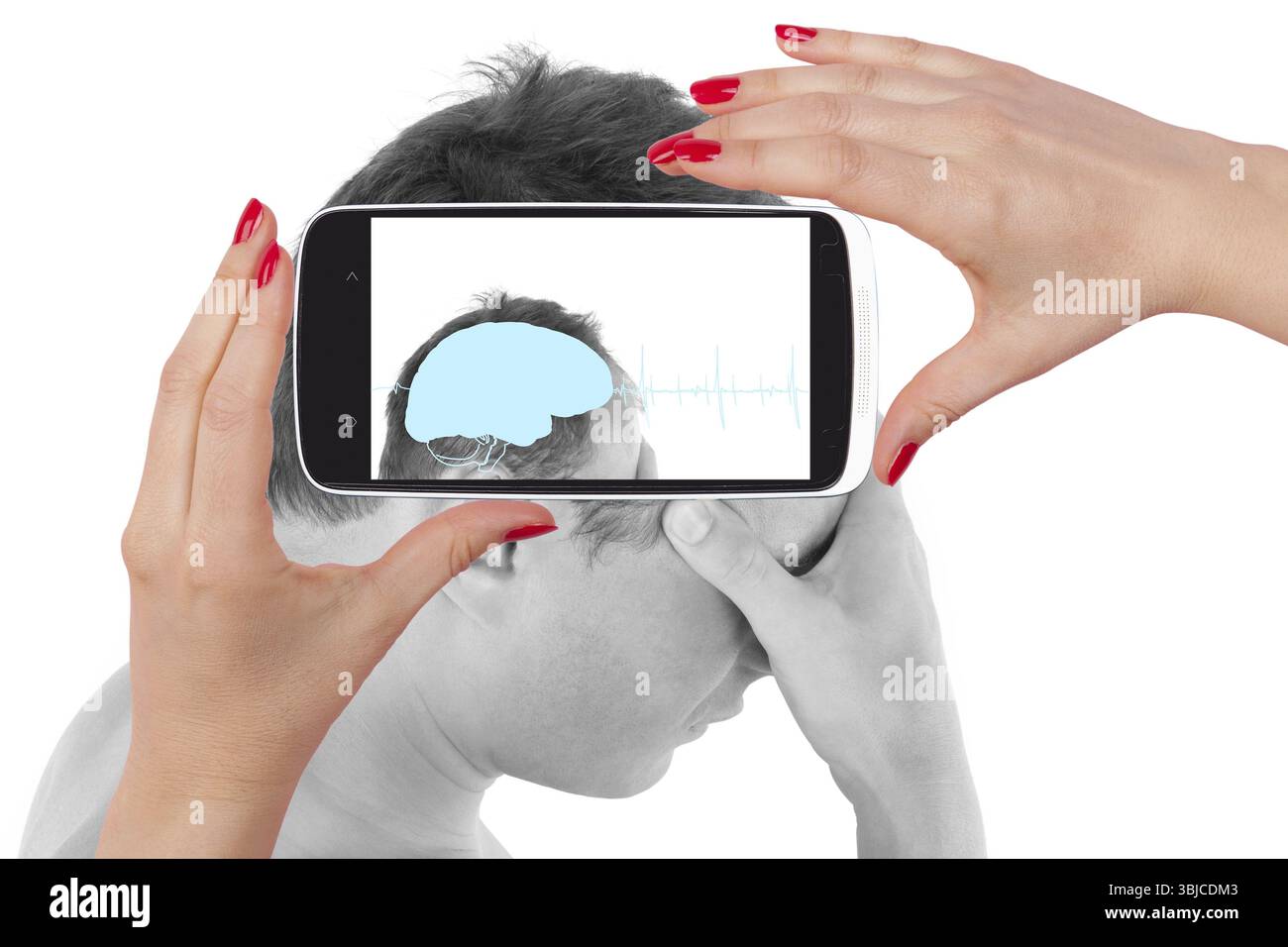 Kopfschmerzen. Junger Mann, der seinen Kopf berührt und die Diagnose auf einem Smartphone-Bildschirm sieht. Die Zukunft der Medizin Stockfoto
