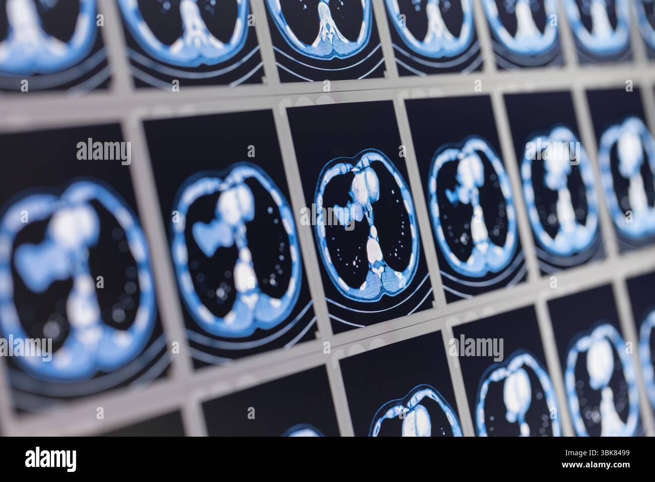 Viele Computertomographie-Scans vor dunklem Hintergrund Nahaufnahme Stockfoto