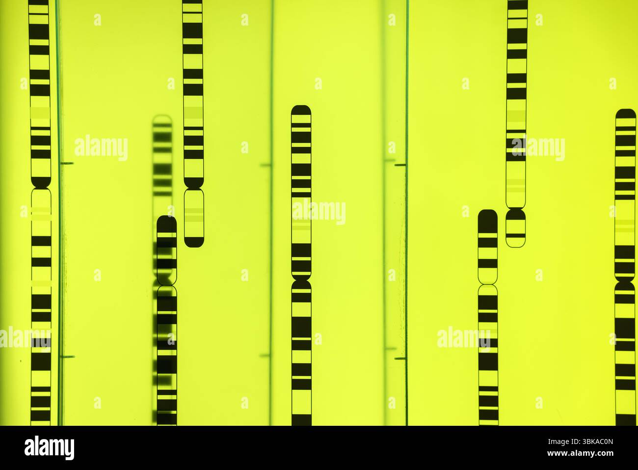 Organisation des Genoms in Chromosomennaht Stockfoto
