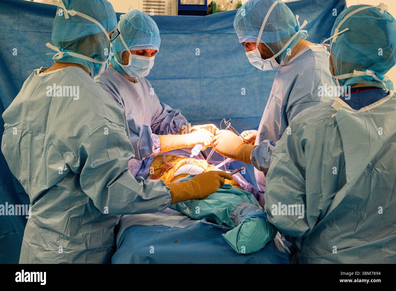 Die Platzierung einer Hüftprothese mit Roboterunterstützung am Lyon-Sud-Krankenhaus. Stockfoto