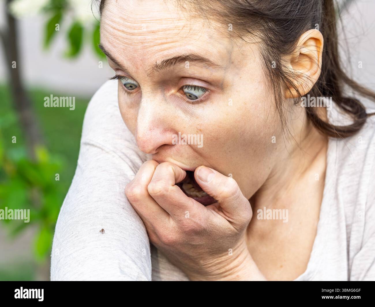 Eine Nahaufnahme einer Hirschzecke, die am Arm einer Person herumkriecht. Die Arachnide ist rötlich gefärbt und hat ihre Beine als Kriechen ausgestreckt Stockfoto