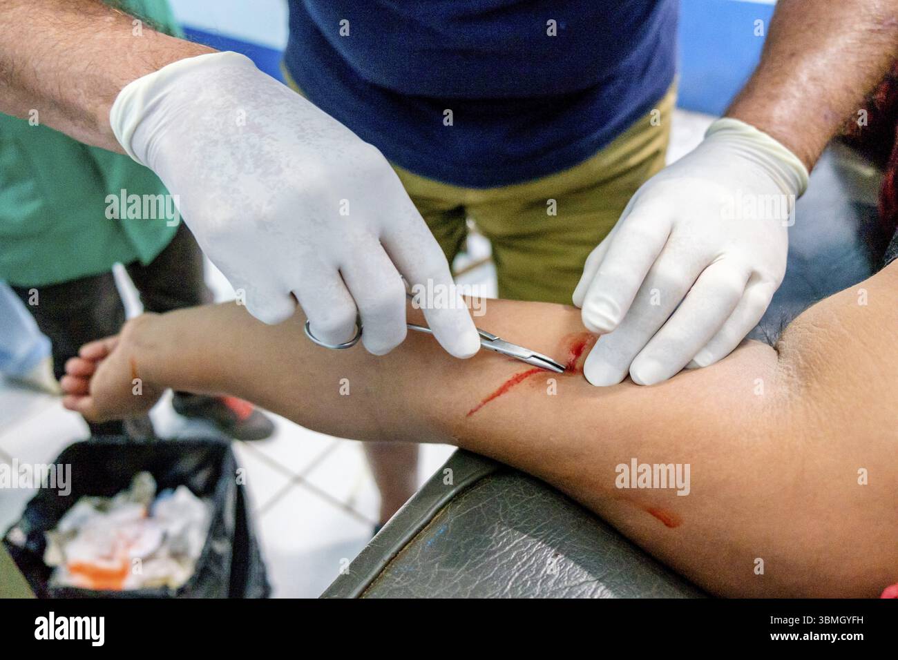 Entfernung von hormonellen Verhütungsmitteln, Lancetillo Gesundheitszentrum, La Parroquia, Quiche, Republik Guatemala, Zentralamerika Stockfoto