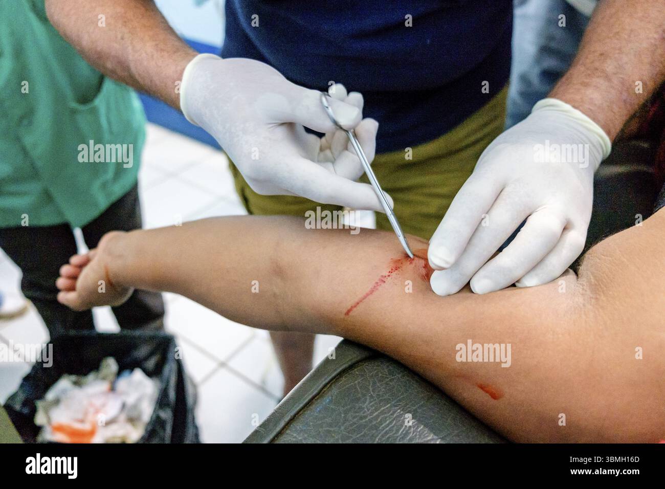 Entfernung von hormonellen Verhütungsmitteln, Lancetillo Gesundheitszentrum, La Parroquia, Quiche, Republik Guatemala, Zentralamerika Stockfoto