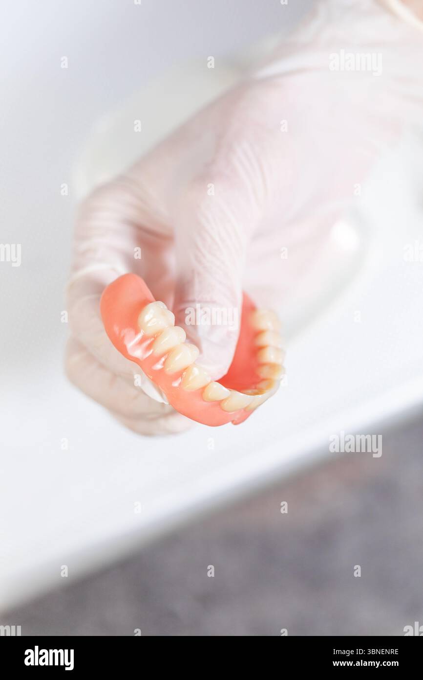 Vertikales Bild einer Hand mit Handschuhen, die eine gebrauchte obere Prothese in sauberer, klinischer Beleuchtung hält. Stockfoto