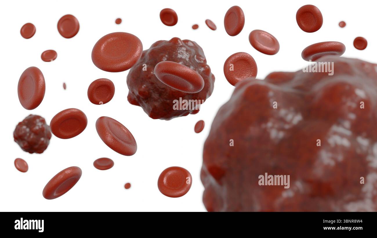 Eine 3D-Darstellung einer Blutprobe, die eine Krebsbildung enthält und eine Darstellung eines Bluttumors oder einer bösartigen Zelle liefert. Stockfoto