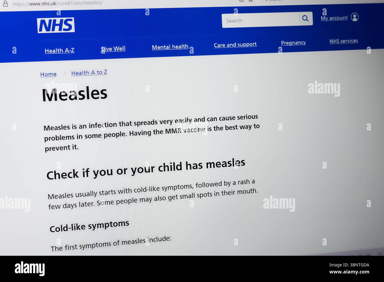 Die NHS-Website mit Informationen über Masern Stockfoto